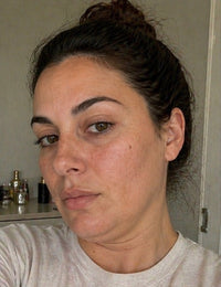 Après